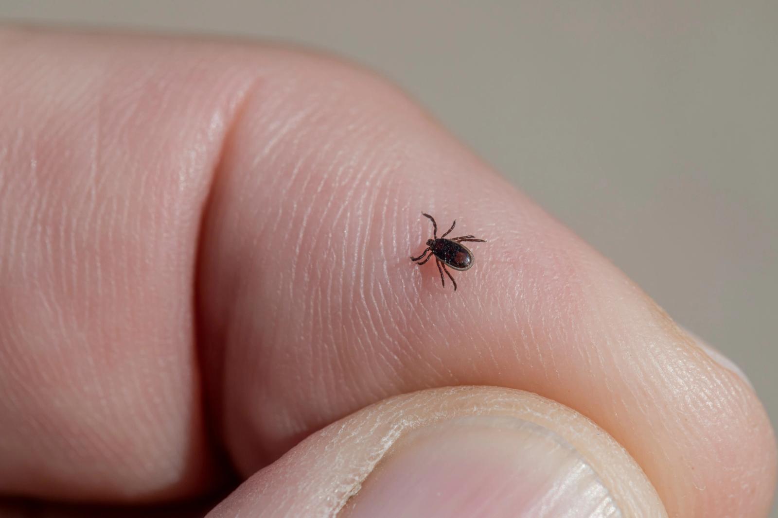 Delvis Delvis vaccinerade kan få svårare TBE-sjukdom än ovaccinerade - Ålands ...